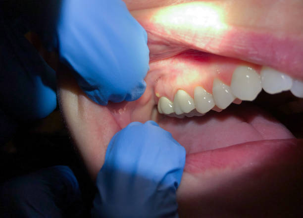 Best Emergency Root Canal Therapy in North Branch, MI